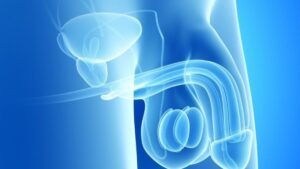 Gençlerde Görülen Sertleşme Sorunu (Venooklüsiv Yetmezlik – Venöz Kaçak)