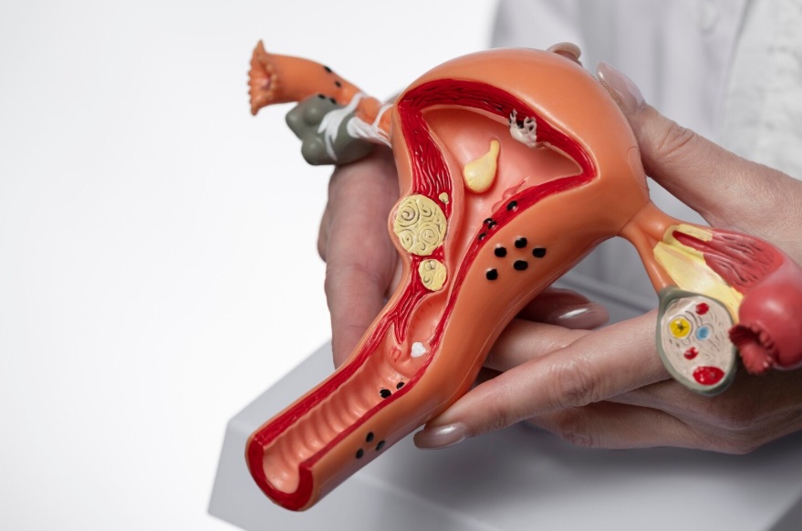 You are currently viewing HPV ve Genital Siğiller Hakkında Sık Sorulan Sorular – Kapsamlı Rehber